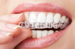 ortodoncia-2
