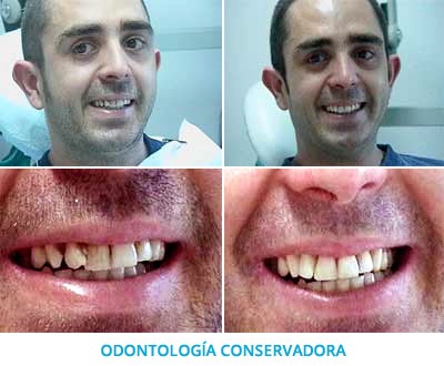 odontologia-conservadora