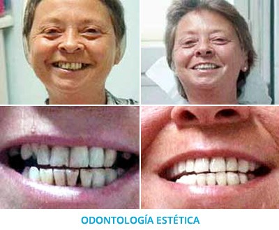 odontologia-estetica-2