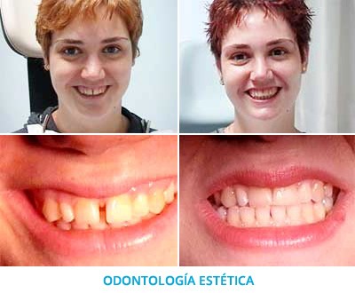 odontologia-estetica