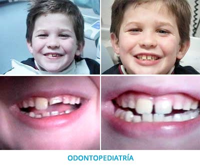 odontopediatria