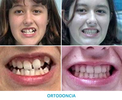 ortodoncia