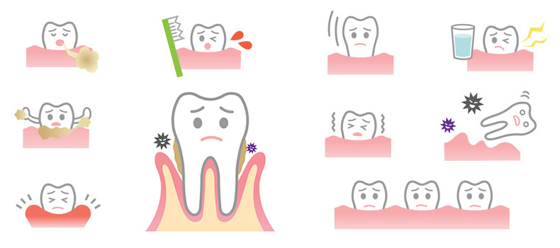 Extracciones Dentales