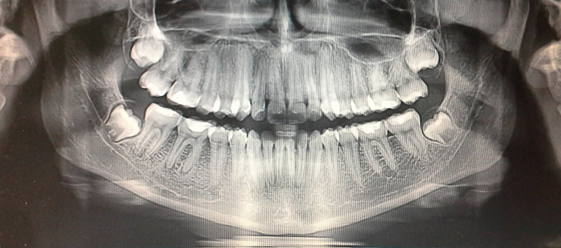 Radiología Dental